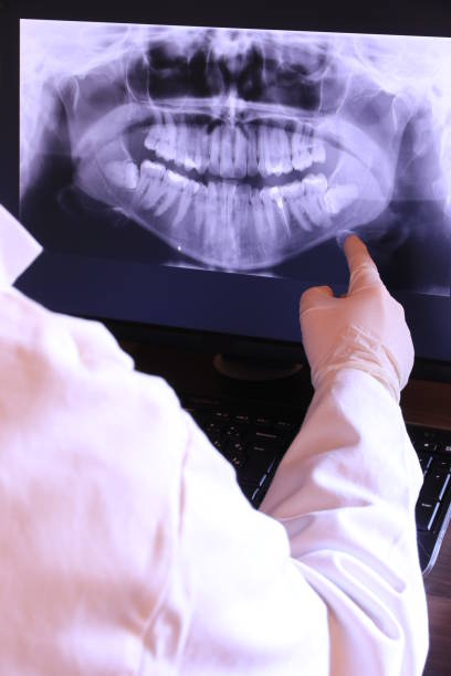 Best Knocked-Out Tooth (Avulsed Tooth) Treatment in Shinglehouse, PA